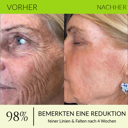 Hergestellt und versandt aus den DE 👉 💝 Healrize® Botox & Vita-A Retinol Shot – Straffende Creme gegen Falten (Wrinkle-Lift) – Aktion am letzten Tag: 60 % Rabatt 💝