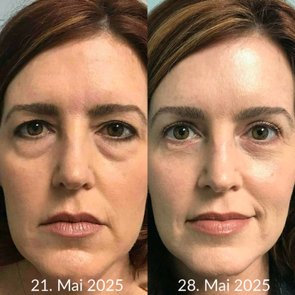Hergestellt und versandt aus den DE 👉 💝 Healrize® Botox & Vita-A Retinol Shot – Straffende Creme gegen Falten (Wrinkle-Lift) – Aktion am letzten Tag: 60 % Rabatt 💝