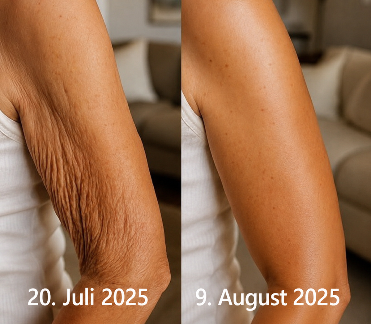 Hergestellt und versandt aus den DE 👉 💝 Healrize® Botox & Vita-A Retinol Shot – Straffende Creme gegen Falten (Wrinkle-Lift) – Aktion am letzten Tag: 60 % Rabatt 💝