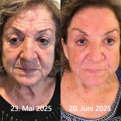 Hergestellt und versandt aus den DE 👉 💝 Healrize® Botox & Vita-A Retinol Shot – Straffende Creme gegen Falten (Wrinkle-Lift) – Aktion am letzten Tag: 60 % Rabatt 💝