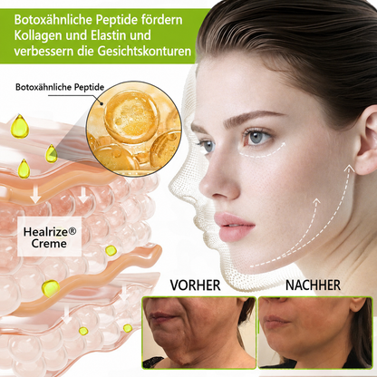 Hergestellt und versandt aus den DE 👉 💝 Healrize® Botox & Vita-A Retinol Shot – Straffende Creme gegen Falten (Wrinkle-Lift) – Aktion am letzten Tag: 60 % Rabatt 💝