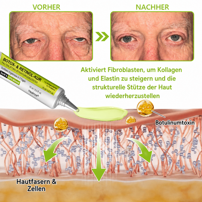 Hergestellt und versandt aus den DE 👉 💝 Healrize® Botox & Vita-A Retinol Shot – Straffende Creme gegen Falten (Wrinkle-Lift) – Aktion am letzten Tag: 60 % Rabatt 💝