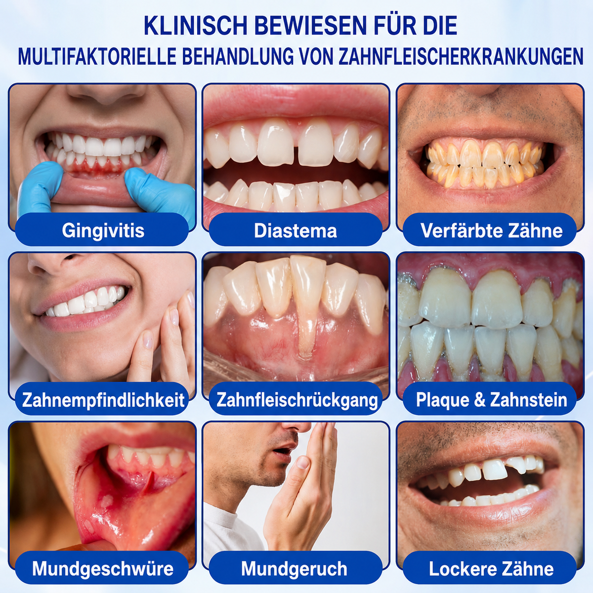 🦷💊Healrize® GumRevive Gel zur Regeneration des Zahnhalteapparats (bei Zahnfleischbluten, Zahnfleischrückgang und lockeren Zähnen)💊