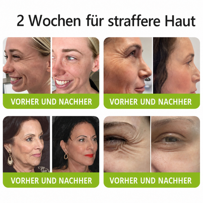 Hergestellt und versandt aus den DE 👉 💝 Healrize® Botox & Vita-A Retinol Shot – Straffende Creme gegen Falten (Wrinkle-Lift) – Aktion am letzten Tag: 60 % Rabatt 💝