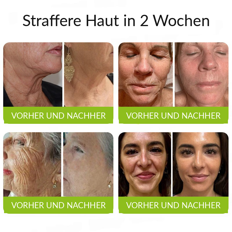 Hergestellt und versandt aus den DE 👉 💝 Healrize® Botox & Vita-A Retinol Shot – Straffende Creme gegen Falten (Wrinkle-Lift) – Aktion am letzten Tag: 60 % Rabatt 💝