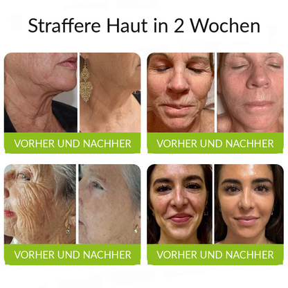 Hergestellt und versandt aus den DE 👉 💝 Healrize® Botox & Vita-A Retinol Shot – Straffende Creme gegen Falten (Wrinkle-Lift) – Aktion am letzten Tag: 60 % Rabatt 💝