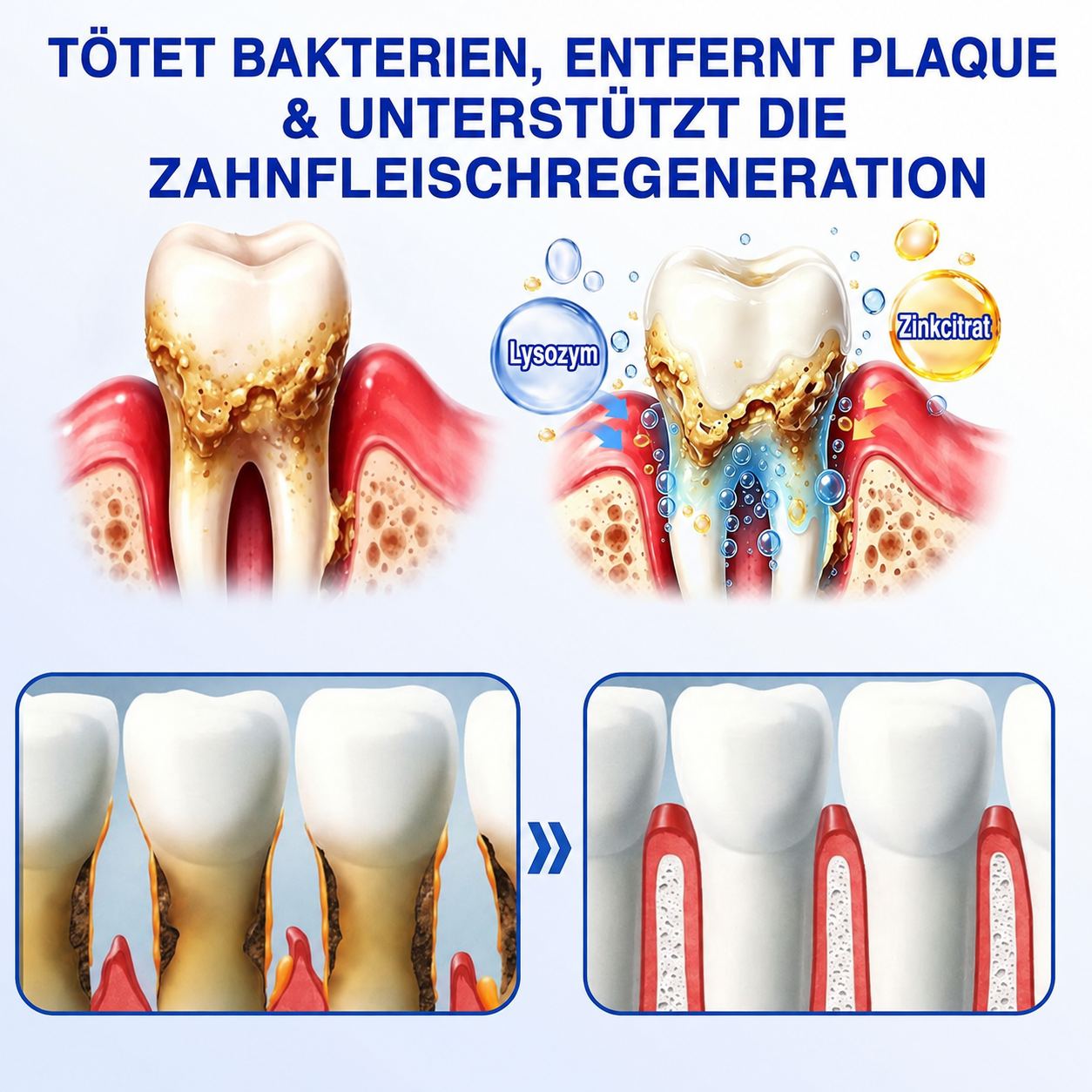 🦷💊Healrize® GumRevive Gel zur Regeneration des Zahnhalteapparats (bei Zahnfleischbluten, Zahnfleischrückgang und lockeren Zähnen)💊