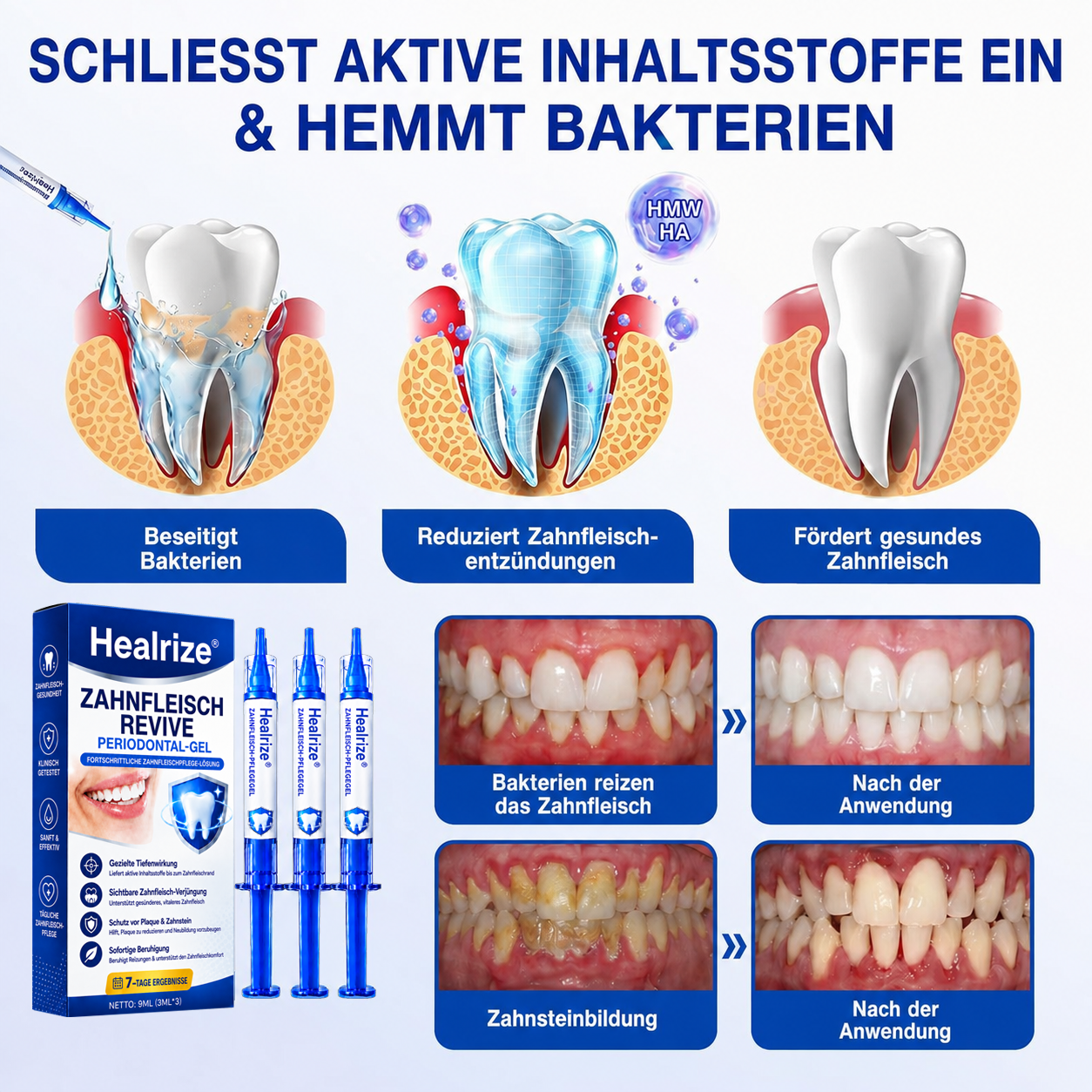 🦷💊Healrize® GumRevive Gel zur Regeneration des Zahnhalteapparats (bei Zahnfleischbluten, Zahnfleischrückgang und lockeren Zähnen)💊