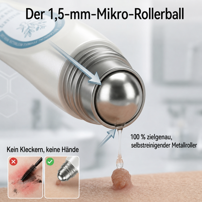 Healrize® 7-Tage Hautmal- & Flecken-Entferner 🌾(Schmerzfrei, Narbenfrei mit Rollball-Applikator)🌾